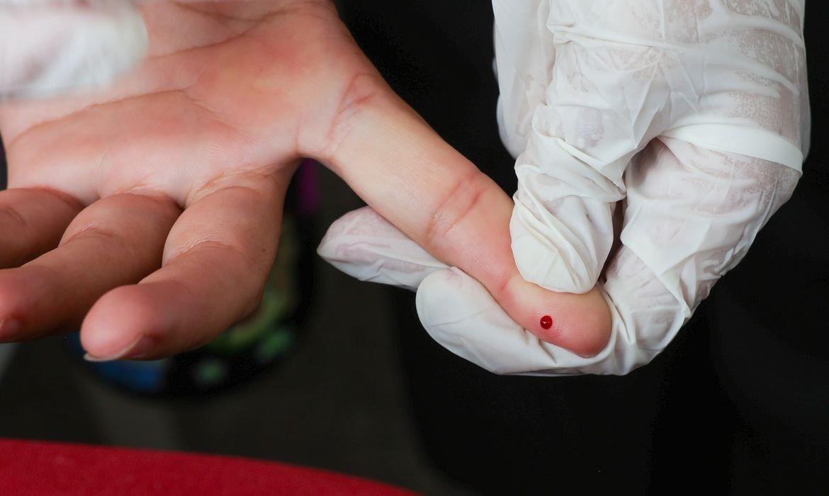 Brasil avança na prevenção da hepatite B