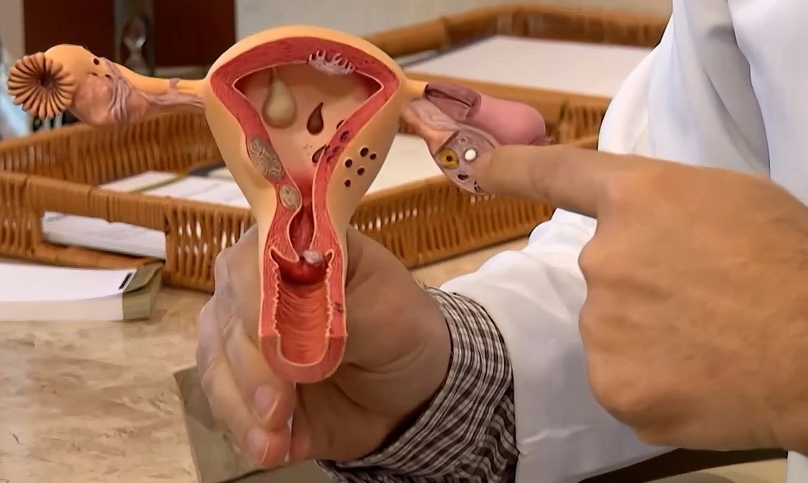 CNPq lança edital para pesquisas sobre endometriose e dor pélvica