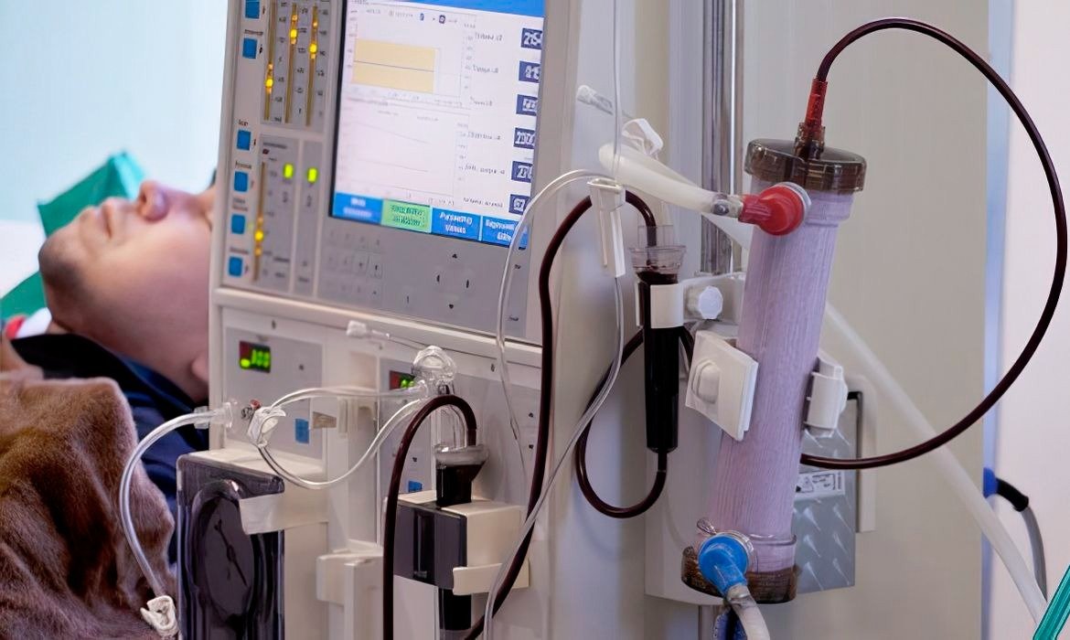 Estudo com 14 mil pessoas alerta sobre saúde renal